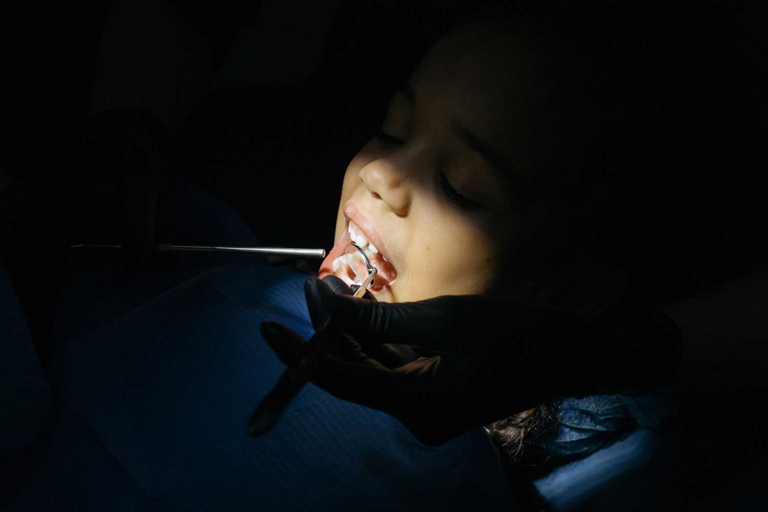 What is Dental Phobia and Dental Anxiety?