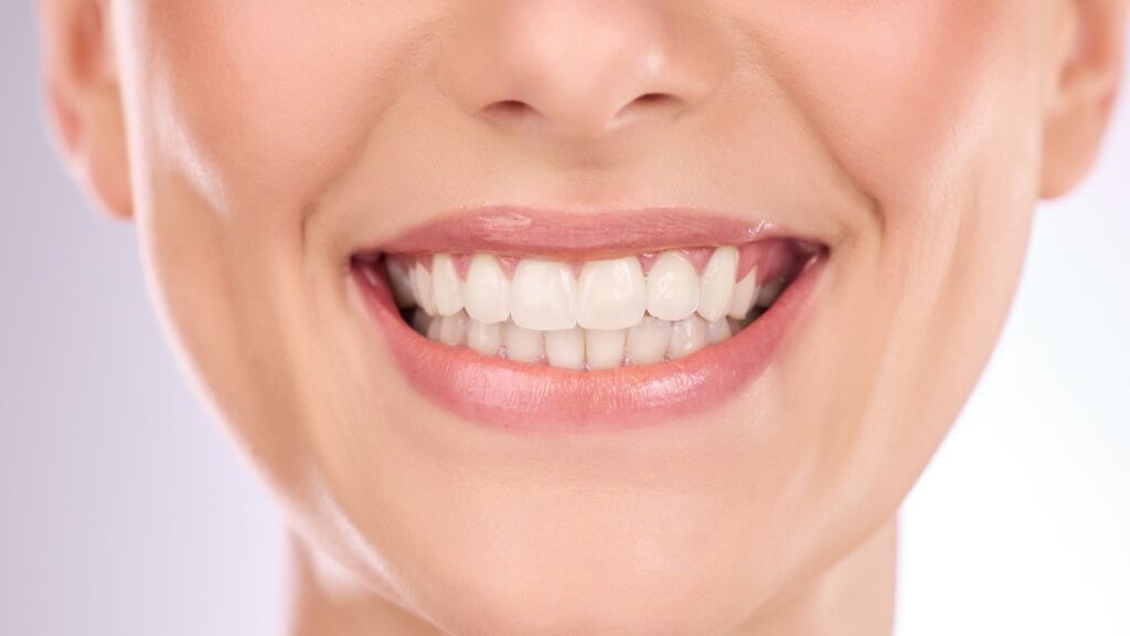 Tooth Whitening